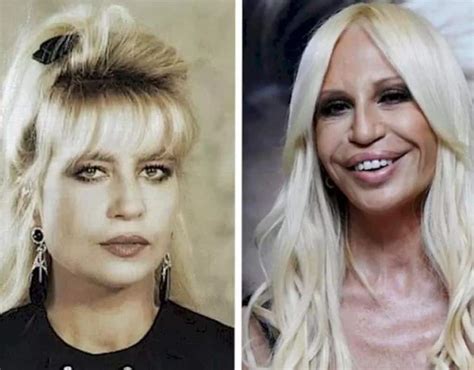 versace face|donatella Versace face what happened.